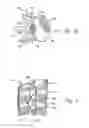 Fig. 08 - Hand-held instruments that access interior body regions