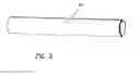 Fig. 03 - Disposable, leveraged mechanical prostate massager