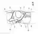 Fig. 20 - Orthopedic supports and method of using same