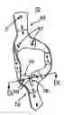 Fig. 01 - Orthotic device and segmented liner