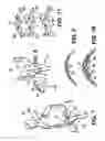 Fig. 04 - Orthotic device and segmented liner