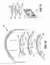 Fig. 08 - Orthotic device and segmented liner