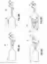 Fig. 03 - Medical fluid injection and inflation system