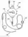 Fig. 01 - INTRAFASCIAL CATHETER INTRODUCER SYSTEM AND METHOD OF DELIVERY OF POSTOPERATIVE ANESTHETICS