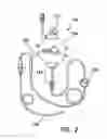 Fig. 03 - INTRAFASCIAL CATHETER INTRODUCER SYSTEM AND METHOD OF DELIVERY OF POSTOPERATIVE ANESTHETICS