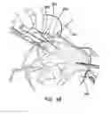 Fig. 06 - INTRAFASCIAL CATHETER INTRODUCER SYSTEM AND METHOD OF DELIVERY OF POSTOPERATIVE ANESTHETICS