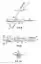 Fig. 06 - Blood collection device