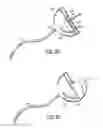 Fig. 15 - Blood collection device