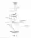 Fig. 10 - Device and method for rapid aspiration and collection of body tissue from within an enclosed body space