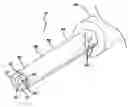 Fig. 01 - Method of removing biliary stones with coaxial catheter device