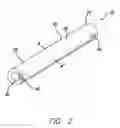 Fig. 03 - Method of removing biliary stones with coaxial catheter device