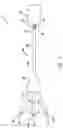 Fig. 06 - Method of removing biliary stones with coaxial catheter device