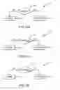 Fig. 14 - Robotic surgical system and method for automated therapy delivery