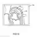 Fig. 20 - Robotic surgical system and method for automated therapy delivery