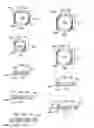 Fig. 04 - Compression stabilizing spacers