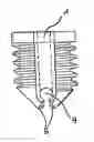 Fig. 01 - Soft tissue anchor