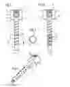 Fig. 02 - Bone anchoring device