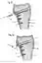 Fig. 06 - Bone anchoring device