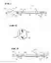 Fig. 02 - Apparatus and method for creating cavities in interior body regions