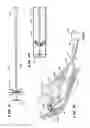 Fig. 05 - Apparatus and method for creating cavities in interior body regions