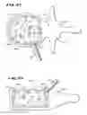 Fig. 09 - Apparatus and method for creating cavities in interior body regions