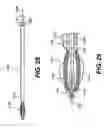 Fig. 43 - Method and apparatus for enhanced delivery of treatment device to the intervertebral disc annulus