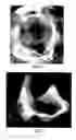 Fig. 05 - Patient selectable joint arthroplasty devices and surgical tools