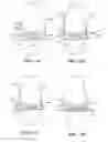 Fig. 12 - Patient selectable joint arthroplasty devices and surgical tools
