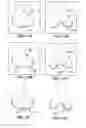 Fig. 16 - Patient selectable joint arthroplasty devices and surgical tools
