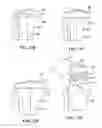 Fig. 23 - Patient selectable joint arthroplasty devices and surgical tools