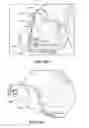 Fig. 36 - Patient selectable joint arthroplasty devices and surgical tools