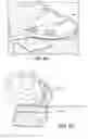Fig. 38 - Patient selectable joint arthroplasty devices and surgical tools