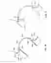 Fig. 44 - Patient selectable joint arthroplasty devices and surgical tools