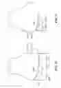 Fig. 45 - Patient selectable joint arthroplasty devices and surgical tools