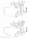 Fig. 47 - Patient selectable joint arthroplasty devices and surgical tools