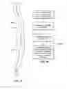 Fig. 52 - Patient selectable joint arthroplasty devices and surgical tools