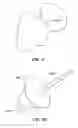 Fig. 55 - Patient selectable joint arthroplasty devices and surgical tools