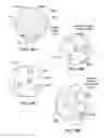 Fig. 59 - Patient selectable joint arthroplasty devices and surgical tools
