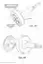 Fig. 61 - Patient selectable joint arthroplasty devices and surgical tools