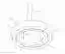 Fig. 01 - OBSTETRICAL VACUUM CUP
