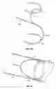 Fig. 15 - METHODS FOR RESTORING BLOOD FLOW WITHIN BLOCKED VASCULATURE
