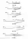 Fig. 18 - METHODS FOR RESTORING BLOOD FLOW WITHIN BLOCKED VASCULATURE