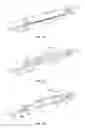 Fig. 04 - METHODS FOR RESTORING BLOOD FLOW WITHIN BLOCKED VASCULATURE
