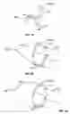 Fig. 14 - METHODS FOR RESTORING BLOOD FLOW WITHIN BLOCKED VASCULATURE