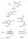 Fig. 16 - METHODS FOR RESTORING BLOOD FLOW WITHIN BLOCKED VASCULATURE
