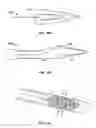 Fig. 19 - METHODS FOR RESTORING BLOOD FLOW WITHIN BLOCKED VASCULATURE