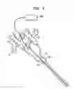 Fig. 05 - Methods and devices for fastener removal