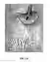 Fig. 02 - Peroral Transgastric Endoscopic Techniques