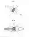 Fig. 03 - Lumen reduction methods and devices
