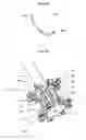 Fig. 04 - Lumen reduction methods and devices